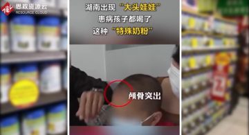 湖南郴州多家母嬰店將蛋白粉<em>充當</em>奶粉售賣，導致<em>多名</em>兒童患上佝僂病